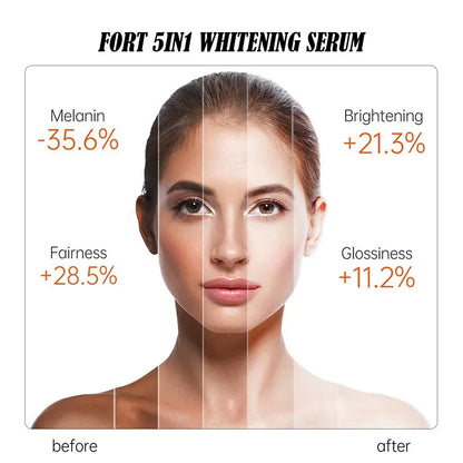 FORT 5IN1 Whitening Serum | Brighten Skin Tone, Removes Dead Skin Whitening Serum | 30ML